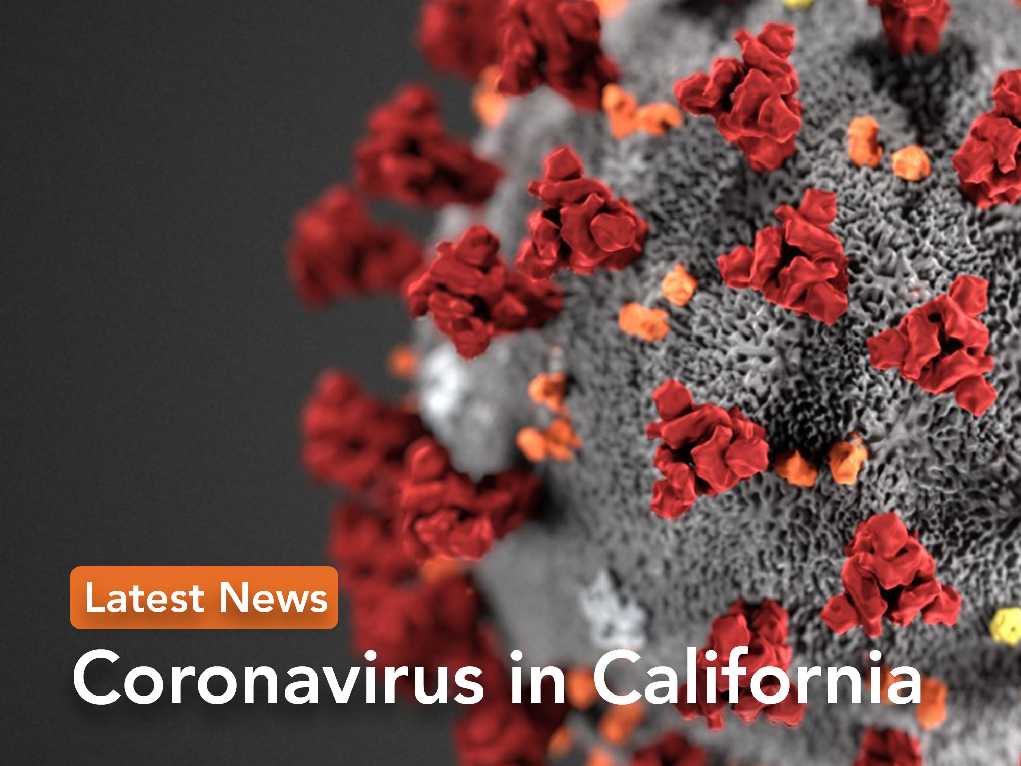 California Coronavirus Updates: CDC Study Shows Adults With COVID-19 Were Twice As Likely To Have Dined Out