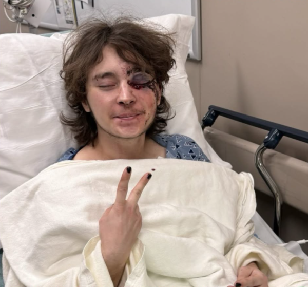 A federal agent allegedly injured this unnamed protester during a protest, causing him permanent blindness in one eye.