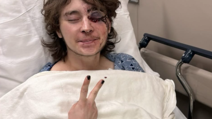 A federal agent allegedly injured this unnamed protester during a protest, causing him permanent blindness in one eye.